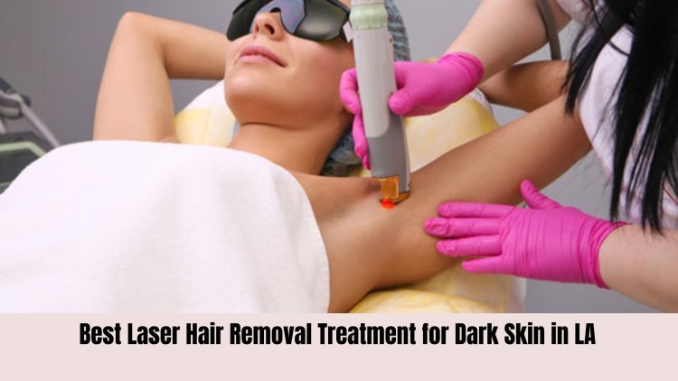 Best Laser Hair Removal Treatment for Dark Skin in LA