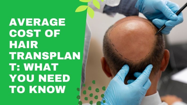 Average Cost of Hair Transplant: What You Need to Know