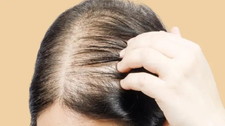 Hair Loss Treatments That You Need to Know in 2025