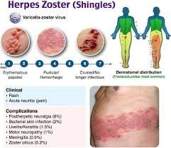 What Are the Signs of a Severe Infection That Requires Immediate Attention?