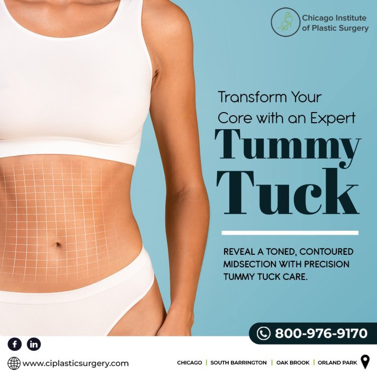 Best Tummy Tuck Surgeon in Chicago | Abdominoplasty Surgery Experts